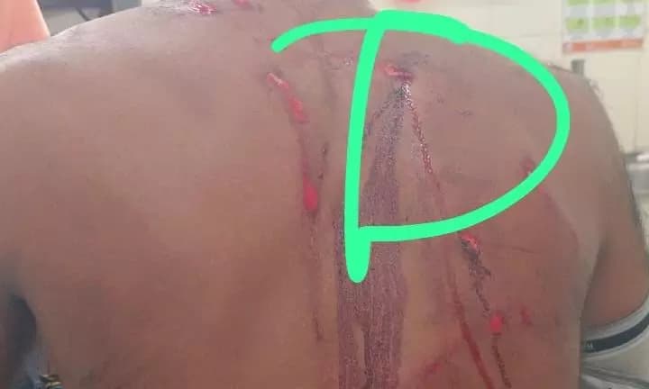 Tiger Attack Leaves Villager Injured in Mysuru's Sargur Taluk Area