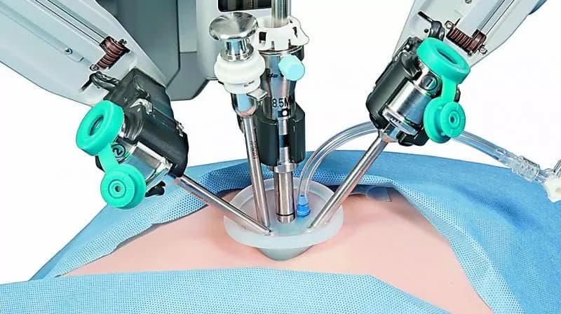 Robotic Surgery Yields Positive Outcomes for Complex Endometriosis Cases